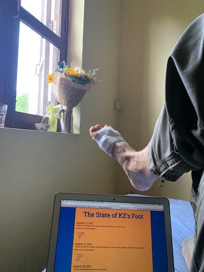 Laptop displaying the State of KZ's Foot webpage, in a homely environment with flowers in the back ground.