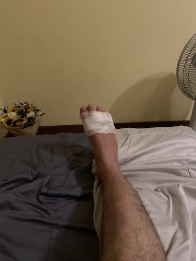 Bandaged foot on bed